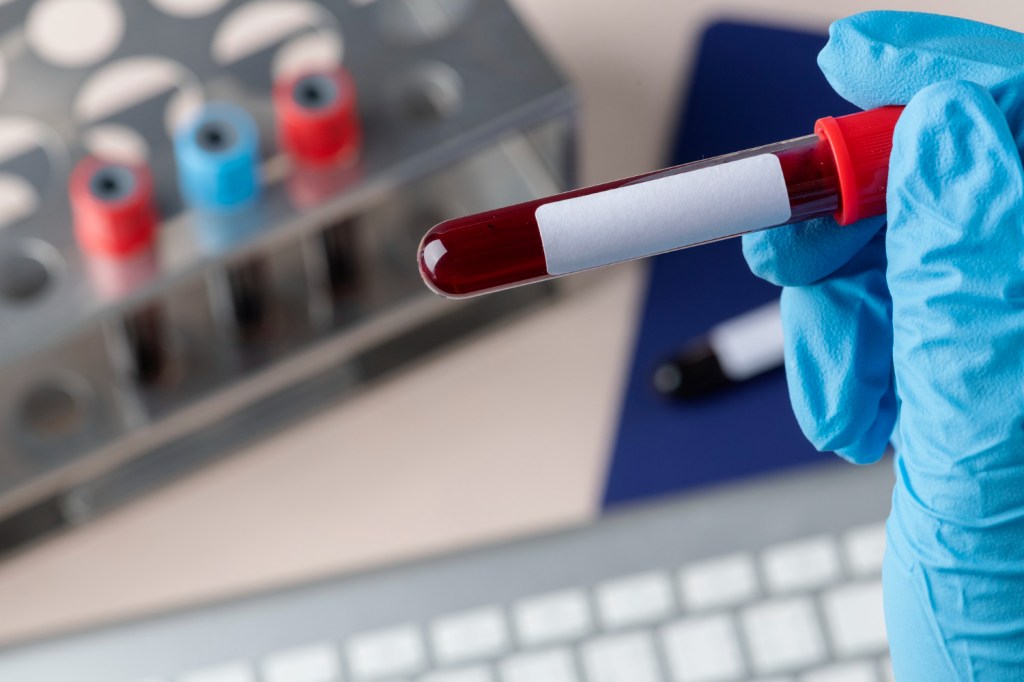 MMG Helps You Arrange Diagnostic Tests for Faster Treatment&nbsp;Abroad